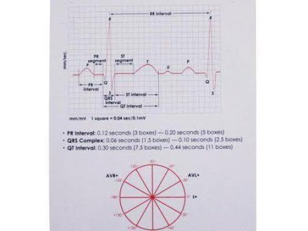 Pocket EKG Ruler Guide Hot on Sale